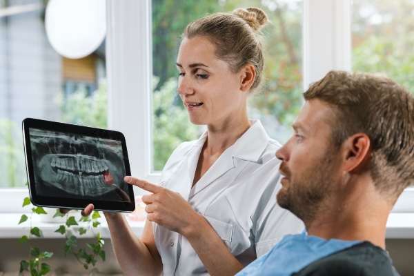 Surgeon showing X-ray to patient